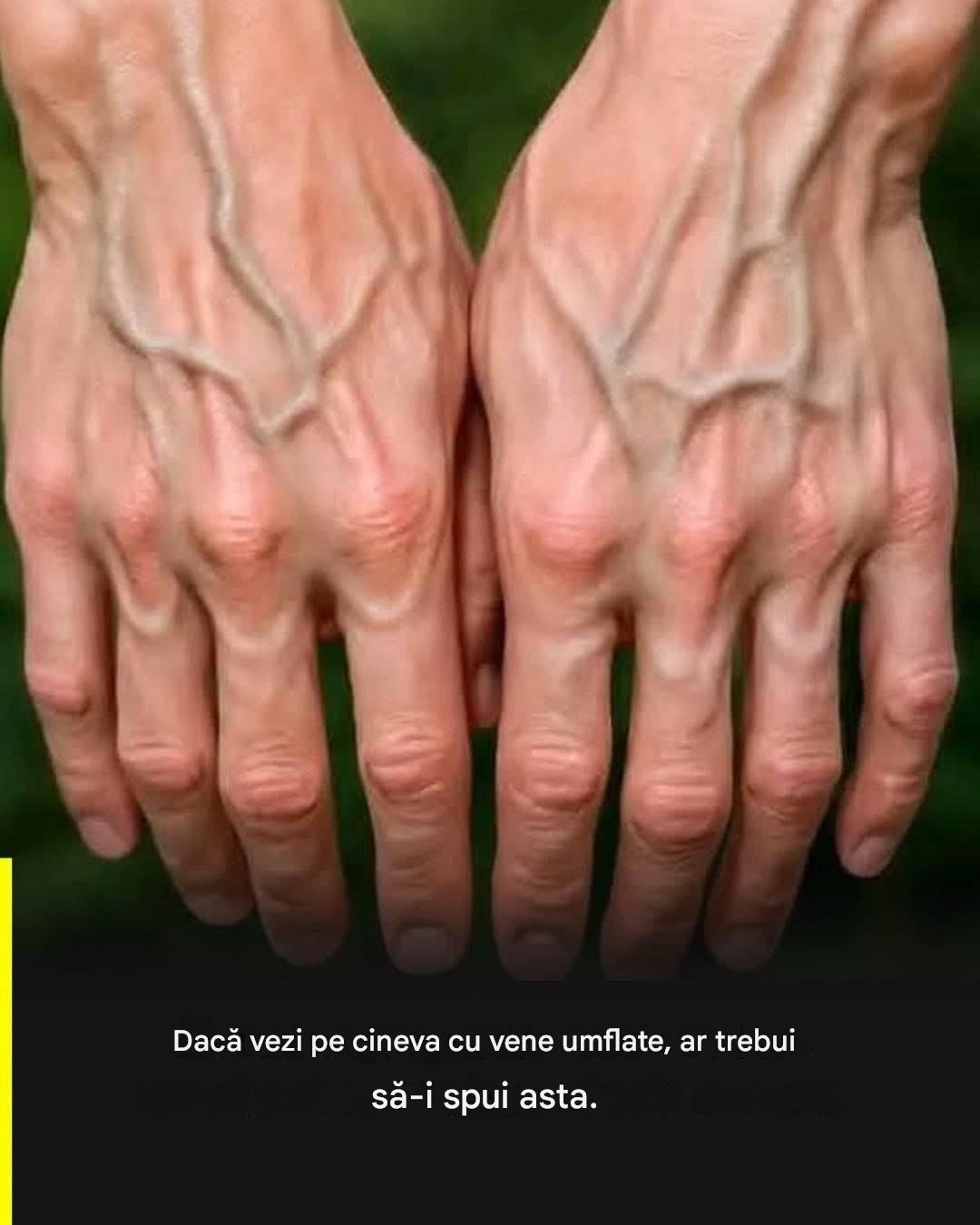 Dacă venele tale sunt vizibile, înseamnă că ești… Vezi mai mult